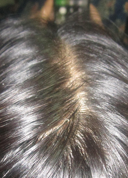 Month 6