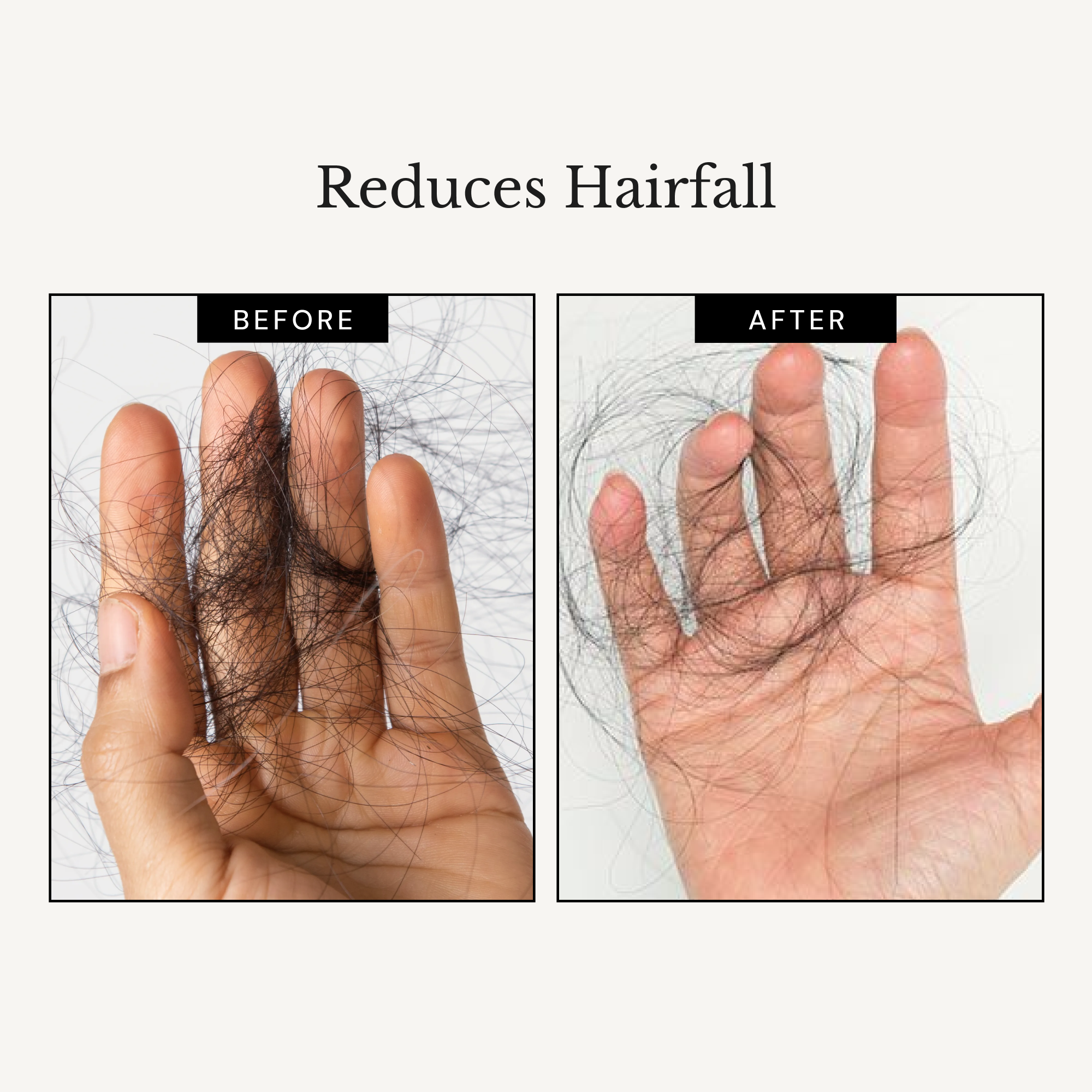 RICHFEEL Scalp Cleanser with Saw Palmetto | Premium Anti-Hair Fall & DHT Blocker Shampoo  (Pack of 2)