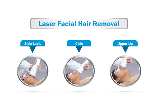 Laser Facial Hair Removal Symptoms Causes Treatment Prevention