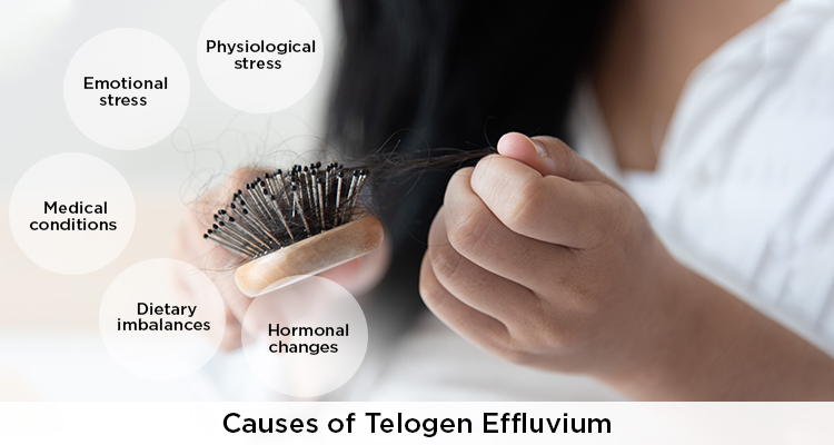 What is Telogen Effluvium? Understand its causes and treatments