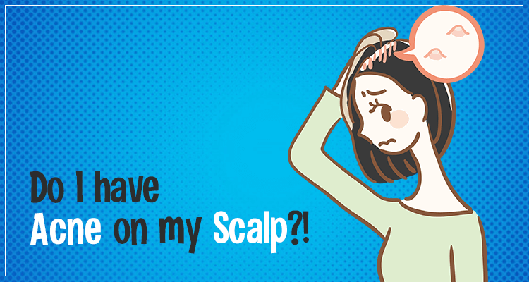 Scalp Folliculitis