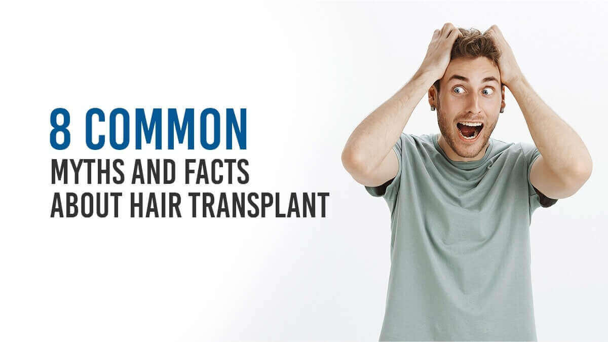 8 common Myths and Facts about Hair Transplant